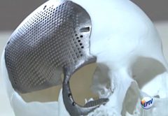 Titanio para la impresión 3D: con un poco de cobre, la aleación perfecta