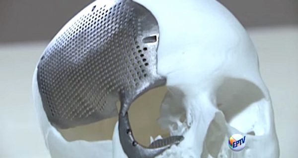 Titanio para la impresión 3D: con un poco de cobre, la aleación perfecta